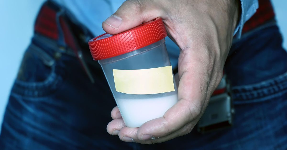 Донор спермы — сколько стоит сдать и купить семенную жидкость
