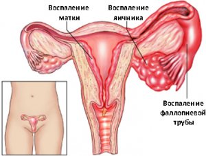 Распространение воспаления