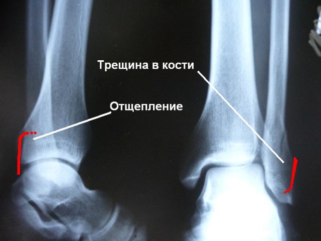 Рентген снимок в диагностике 
