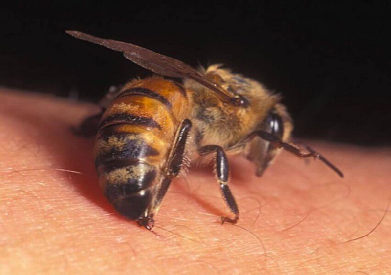 Апитерапия при гипертонии: лечение пчелиным ядом