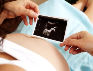 Как влияют мультифолликулярные яичники на беременность